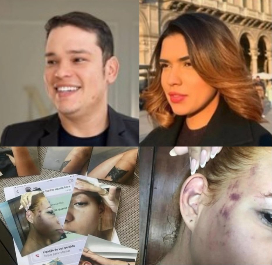 Potiguar deixou o Brasil para não ser vítima de feminicídio e denuncia dentista nas redes sociais