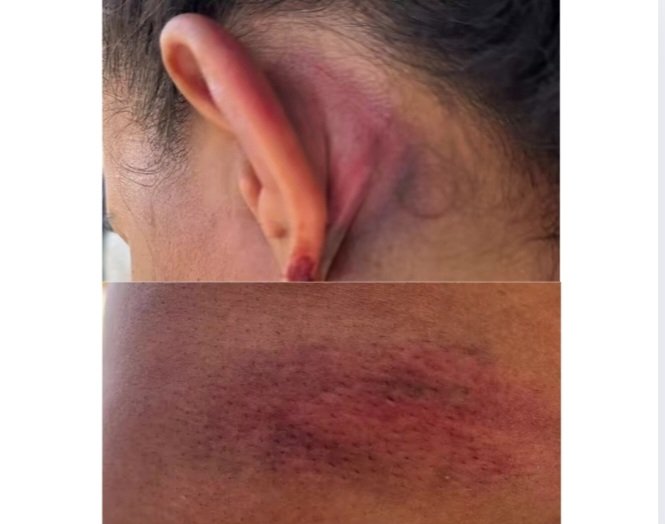 Secretaria de Segurança afasta policiais e investiga agressão a advogada em Serra do Mel